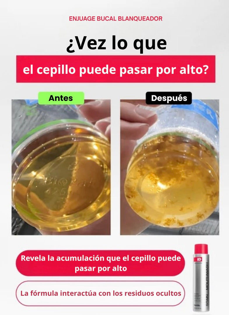 Enjuague Bucal Blanqueador iD STAIN