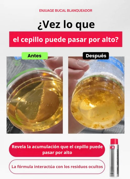 Enjuague Bucal Blanqueador iD STAIN